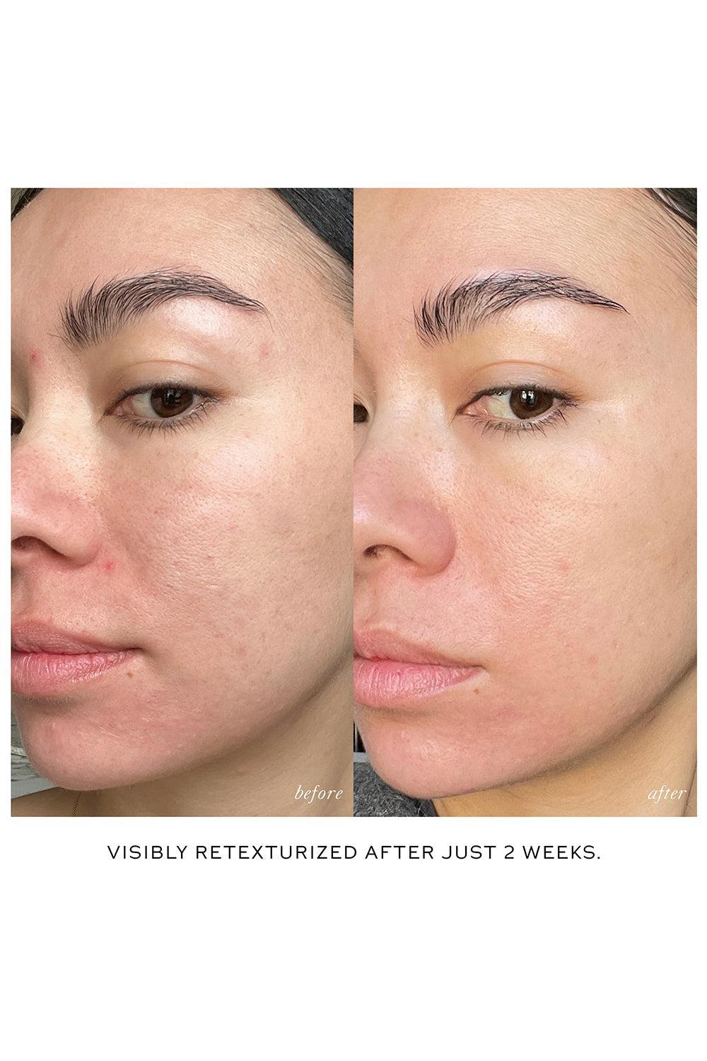 Skin Activator Rollerball-BEAUTYSKINCARE-WESTMAN ATELIER