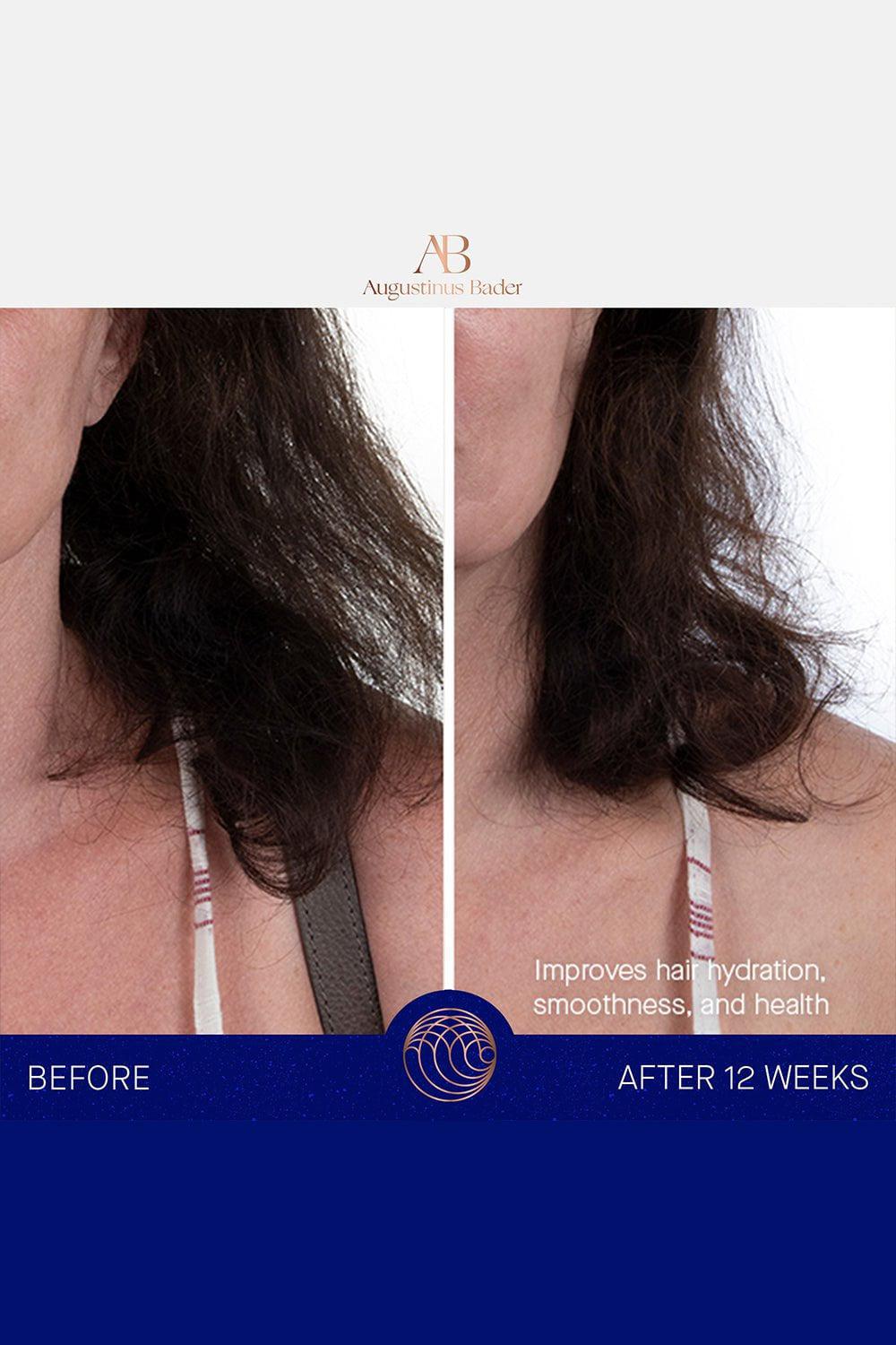 AUGUSTINUS BADER-The Leave-In Hair Treatment-100ML
