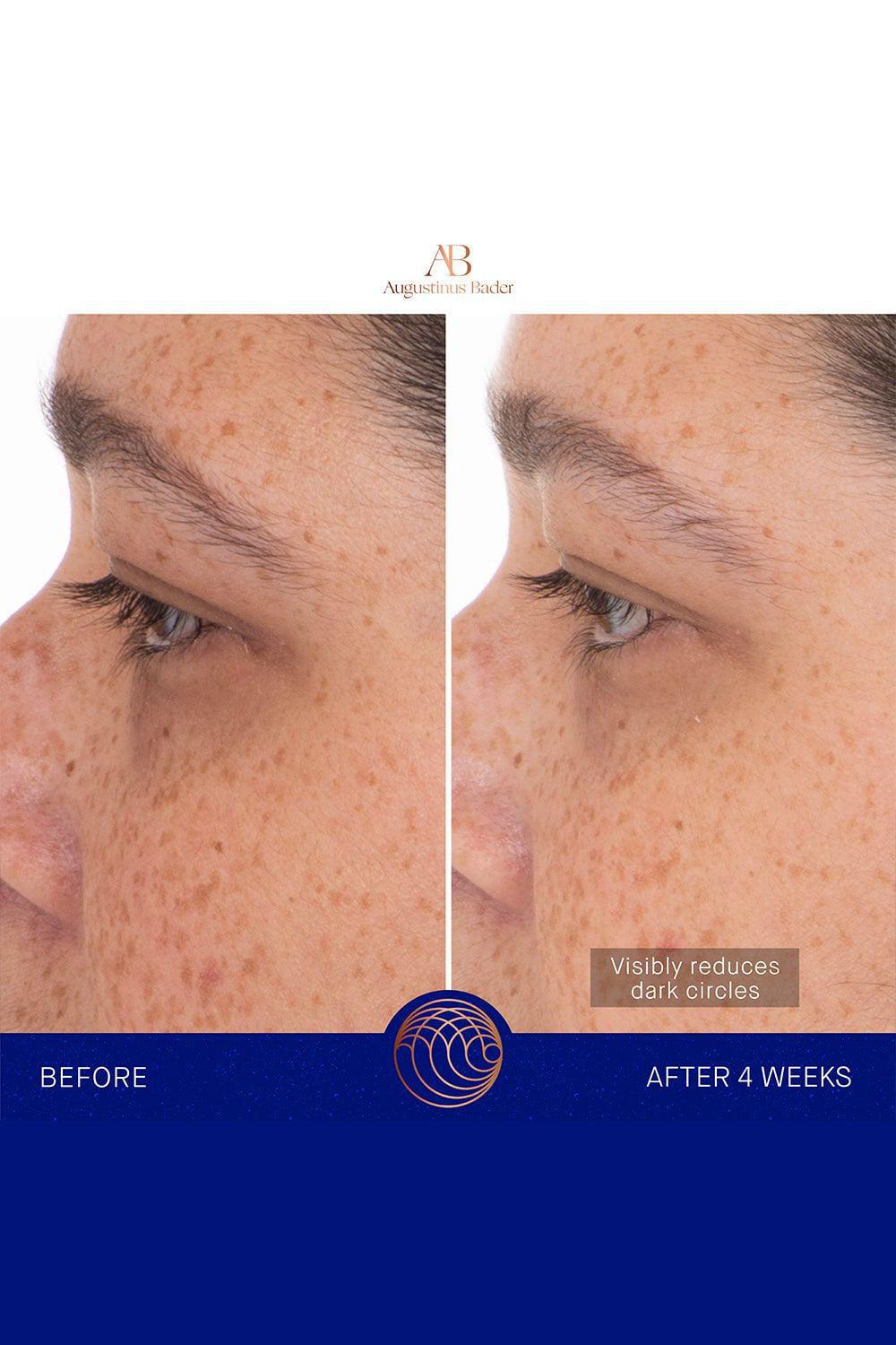 The Eye Patches Single-SINGLE-BEAUTYSKINCARE-AUGUSTINUS BADER